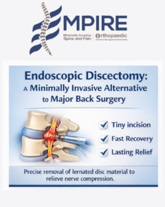Endoscopic Discectomy: Minimally Invasive Relief for Herniated Discs