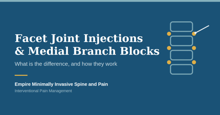 Illustration of facet joints in the spine and an image-guided injection