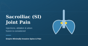 Illustration of the sacroiliac joints where the spine meets the pelvis