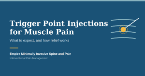 Illustration of a trigger point injection into a muscle knot
