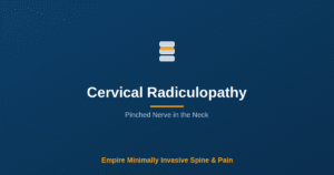 Cervical radiculopathy (pinched nerve in the neck) — Empire Minimally Invasive Spine and Pain