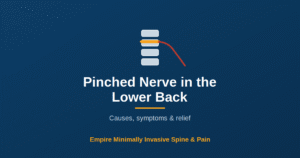 Pinched nerve in the lower back — Empire Minimally Invasive Spine and Pain