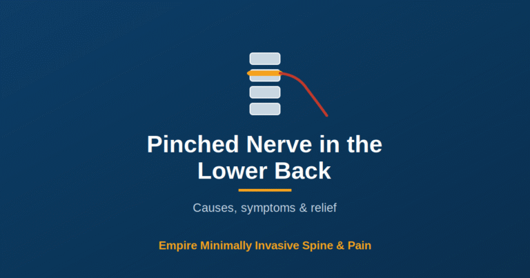 Pinched nerve in the lower back — Empire Minimally Invasive Spine and Pain